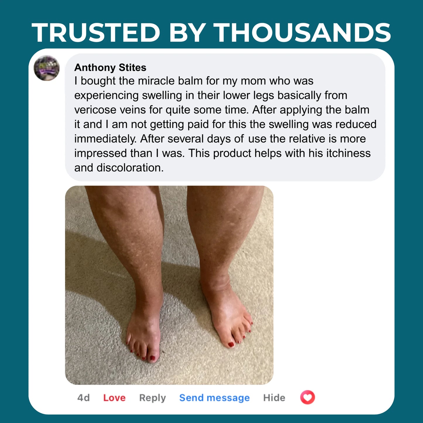 HerbiVein Miracle Balm